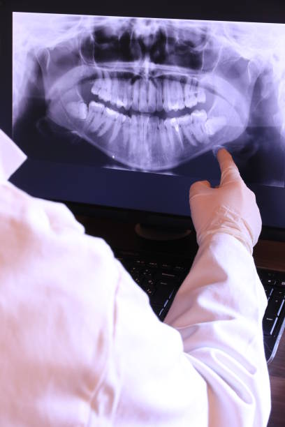 Best Root Canal Emergency Dentist  in Beechwood, MI