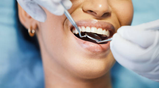 Best Emergency Tooth Extraction  in Beechwood, MI